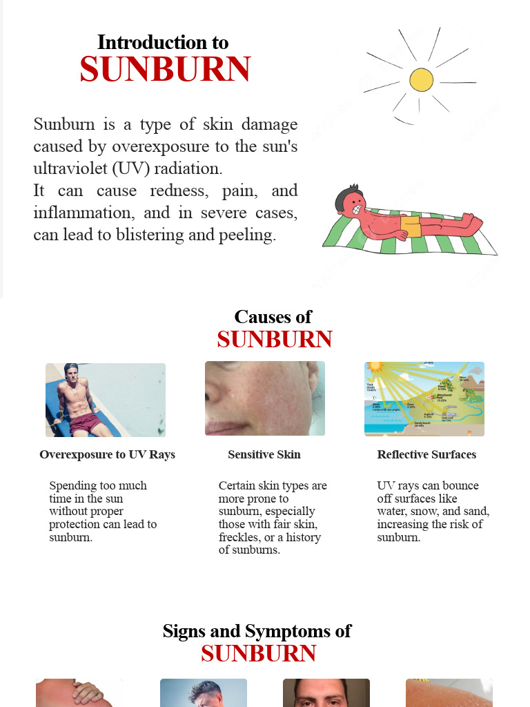 Understanding Sunburn: Causes & Care | PDF | Clinical Medicine ...