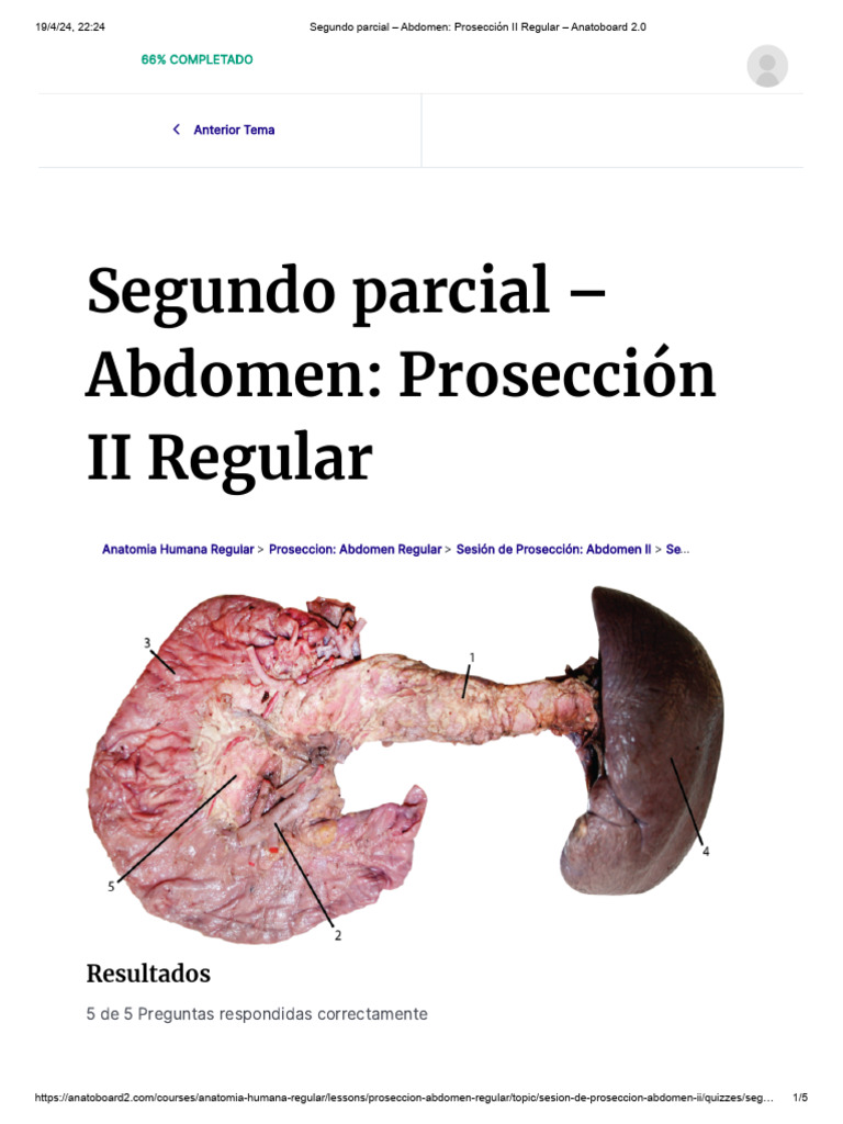 Segundo Parcial de Prosección Abdomen II | PDF | Páncreas | Abdomen