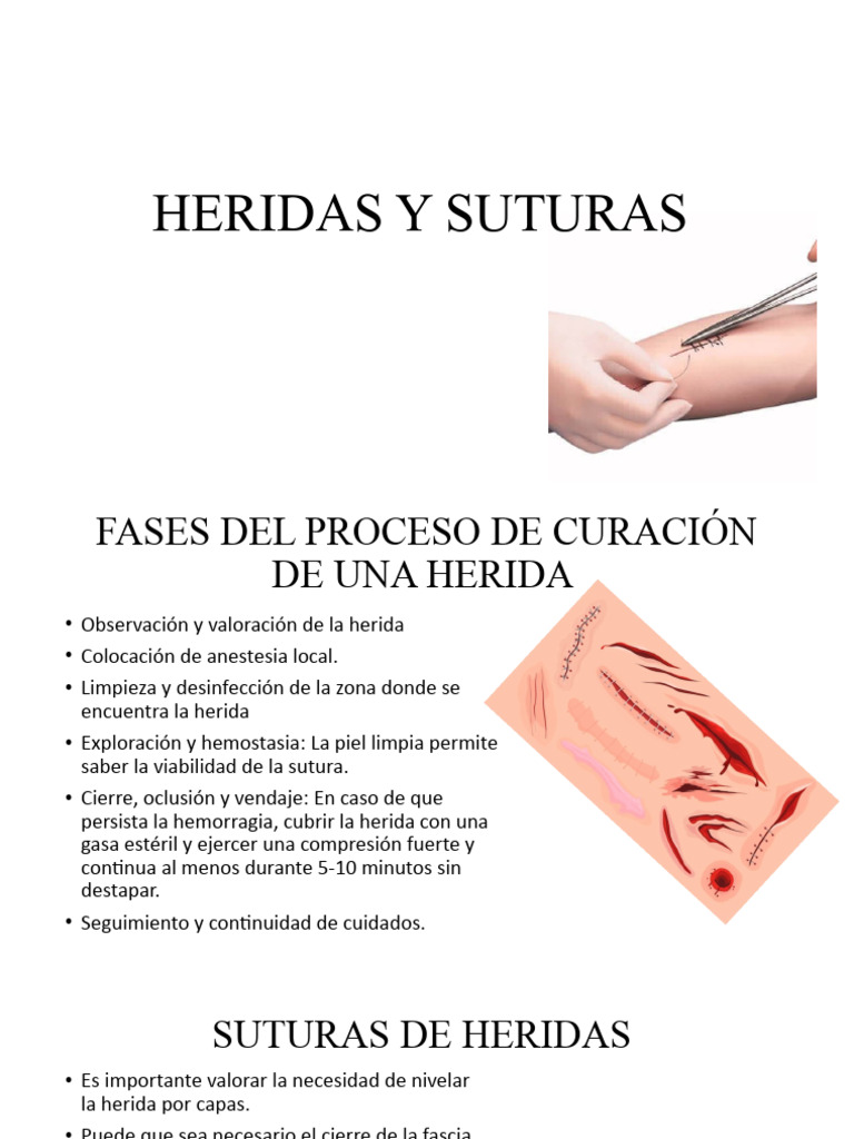 Heridas Y Suturas Pdf Herida Sutura Quirúrgica