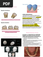 Planejamento de Prótese Parcial Removível | PDF | Dente | Áreas da ...
