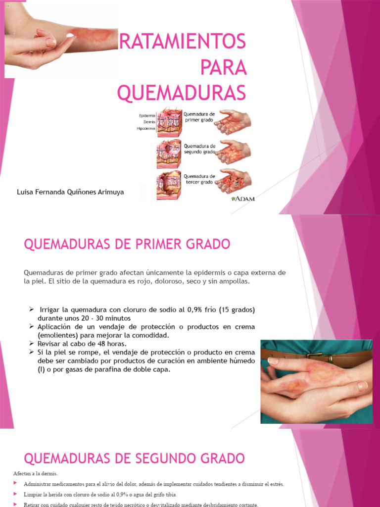 Tratamientos Efectivos para Quemaduras | PDF | Herida | Quemar