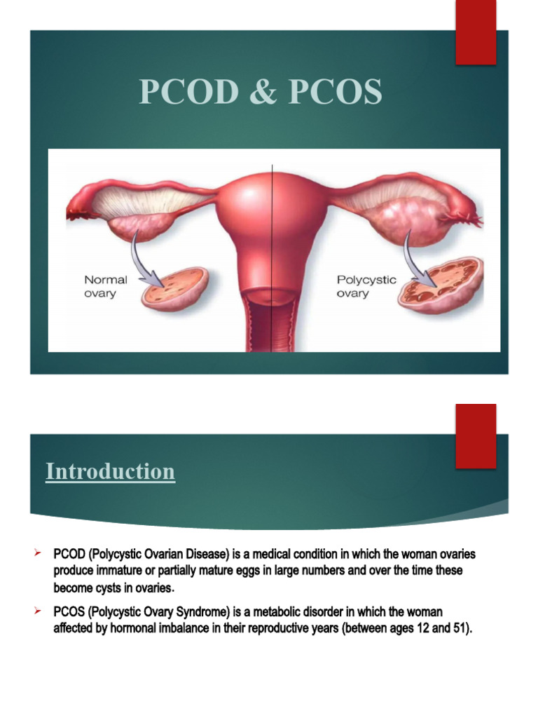 Understanding PCOD vs. PCOS Differences | PDF | Polycystic Ovary ...
