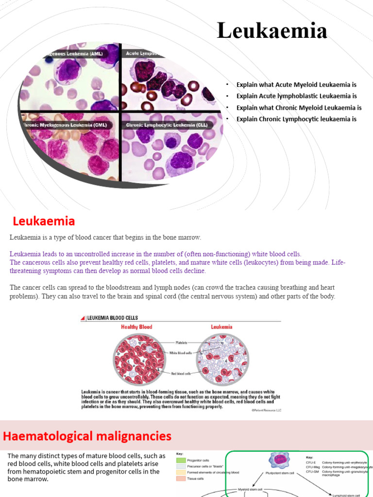 Types and Insights on Leukaemia | PDF | Leukemia | Clinical Medicine