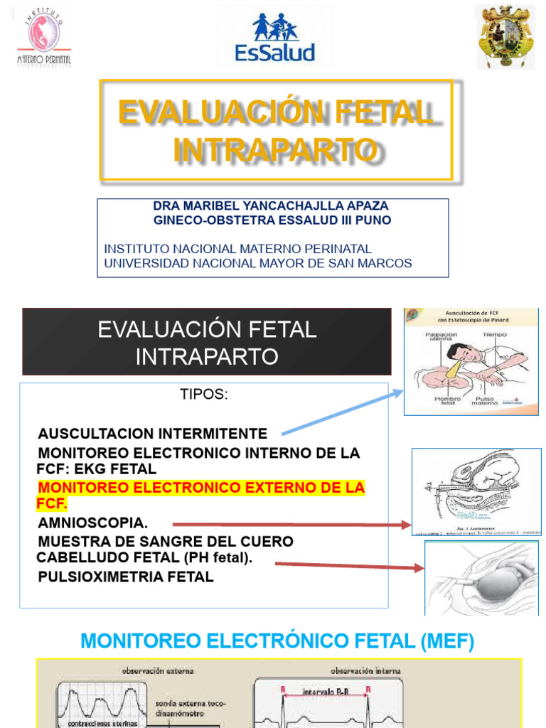 Clase 2 Mef Intraparto, Sfa | PDF | Placenta | Feto