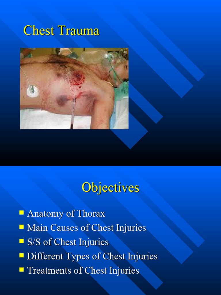 Hemothorax and Flat Neck Veins in Trauma | PDF | Thorax | Major Trauma