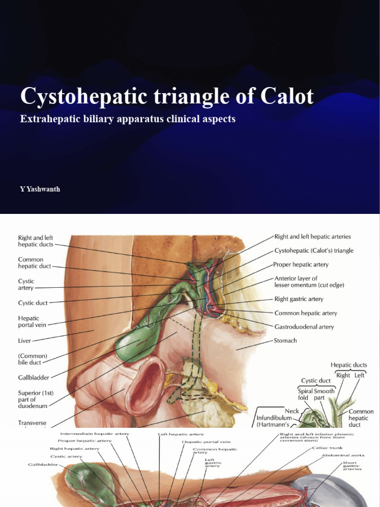Cholecystitis and Biliary Anatomy Insights | PDF | Gallbladder | Liver