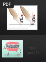 MBT | PDF | Orthodontics | Dental Anatomy
