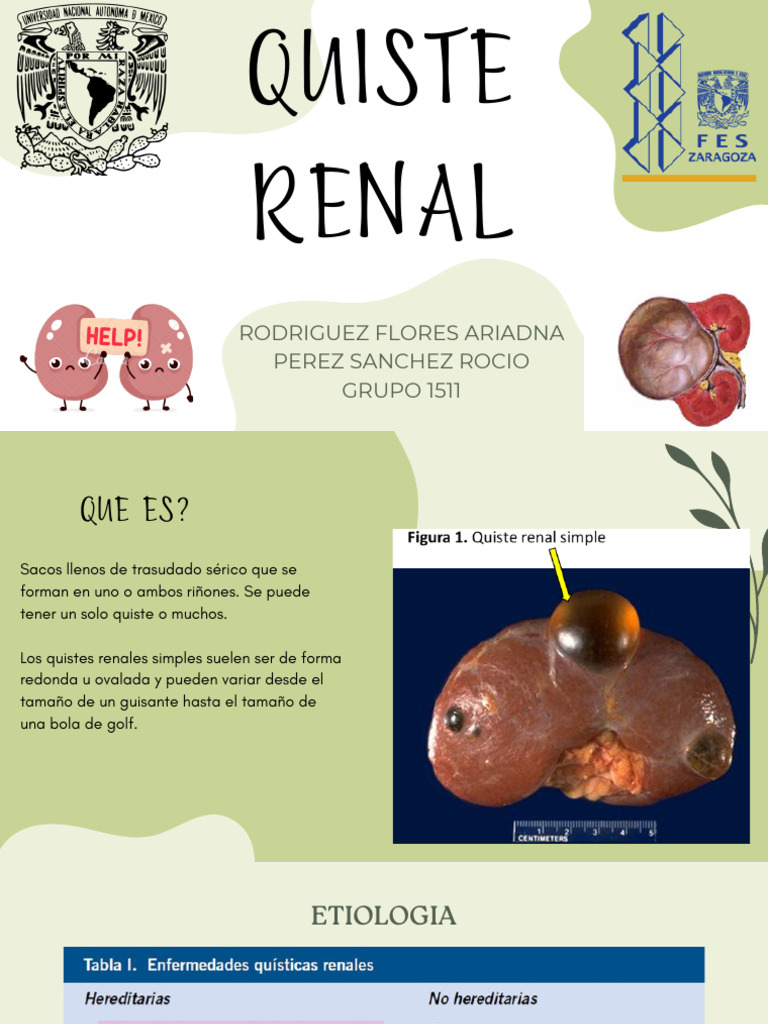 Quiste Renal - 20240212 - 130211 - 0000 | PDF | Riñón | Imagen de ...