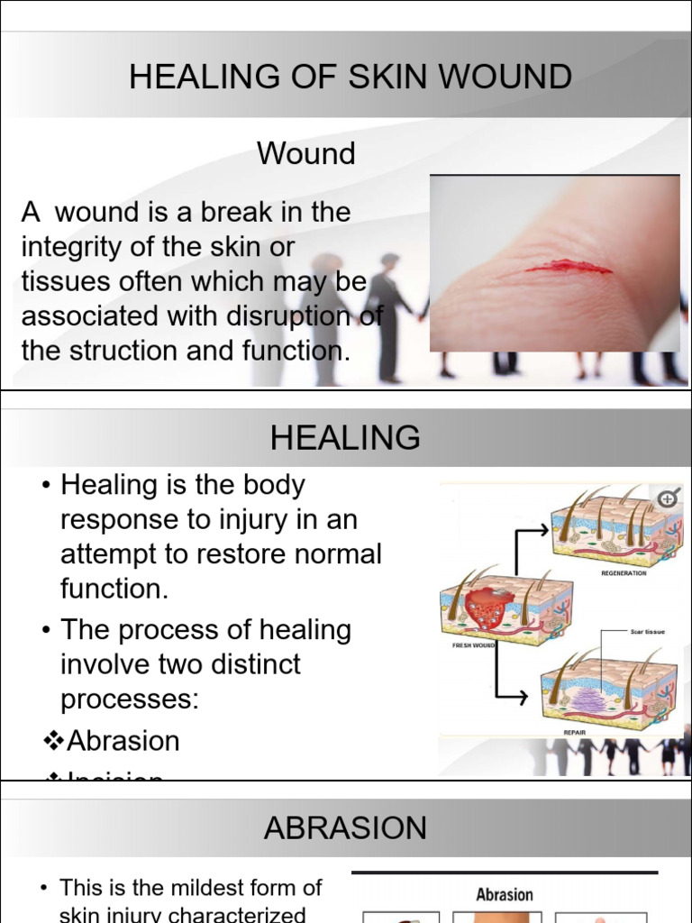 HEALING OF SKIN WOUND(4) | Download Free PDF | Wound Healing | Healing