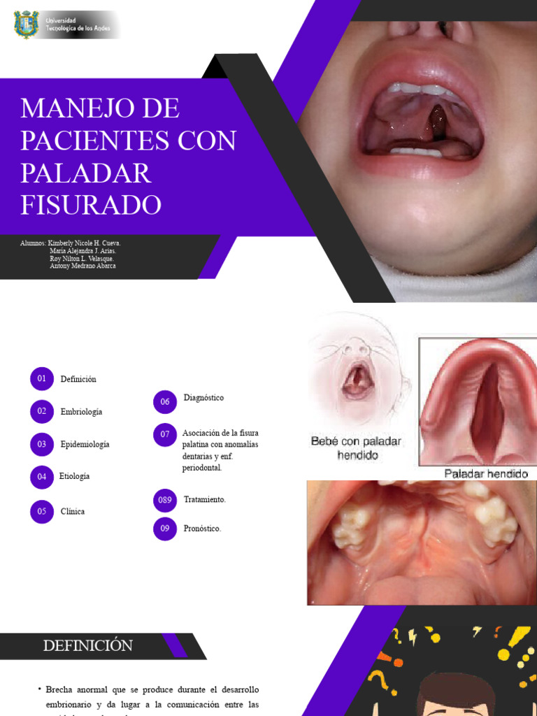 Manejo del Paladar Fisurado en Pacientes | PDF | Diente | Odontología