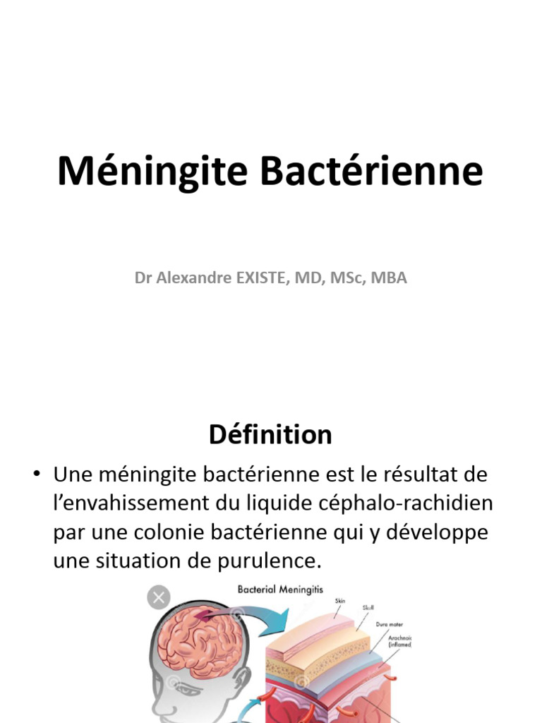 Méningite Bactérienne Causes et Symptômes PDF Méningite — free download