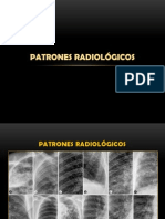 Patrones radiológicos pulmonares: alveolar, intersticial, destructivo y otros