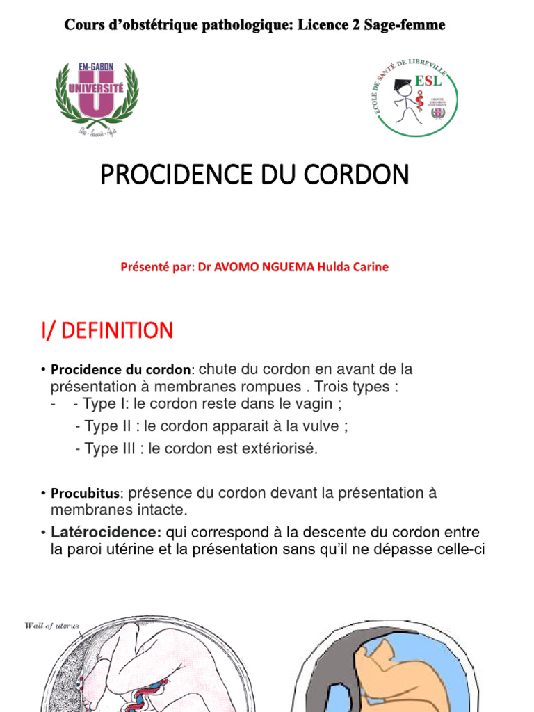 Procidence du cordon : définitions et enjeux | PDF | Accouchement ...