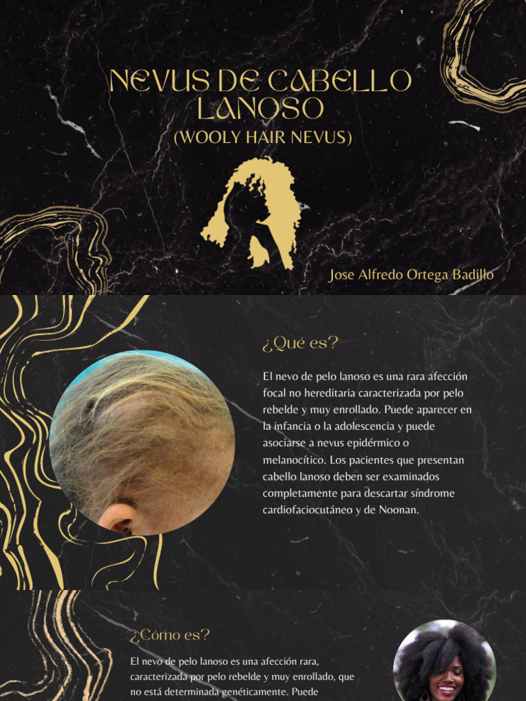 Woolly Hair | PDF
