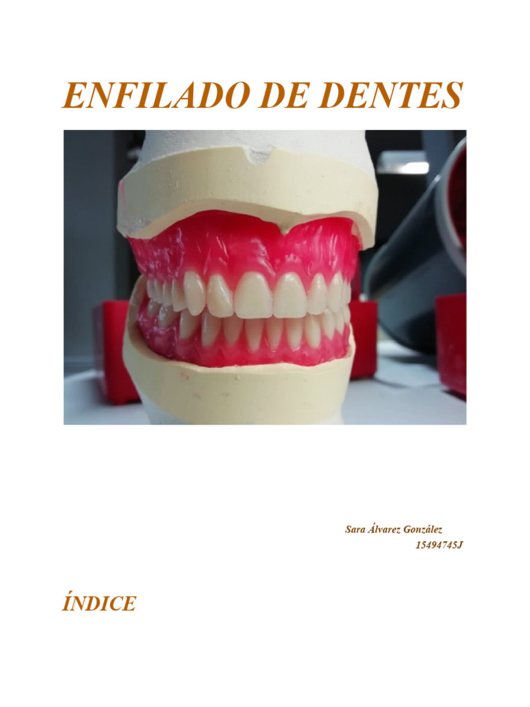 Enfilado de Dentes | PDF