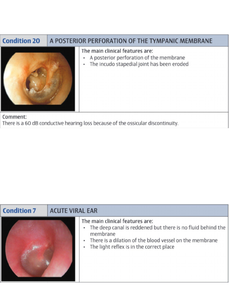 Eye and ENT Slides | PDF