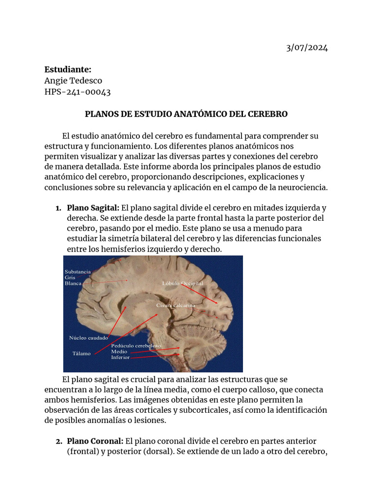 Planos Anatómicos del Cerebro en Neurociencia | PDF | Cerebro | Neuroimagen