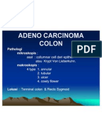 Adeno Carcinoma Colon