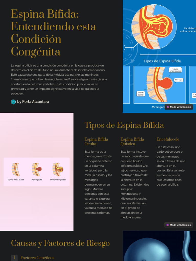 Espina Bífida: Tipos, Causas y Tratamientos | PDF | Enfermedades y ...