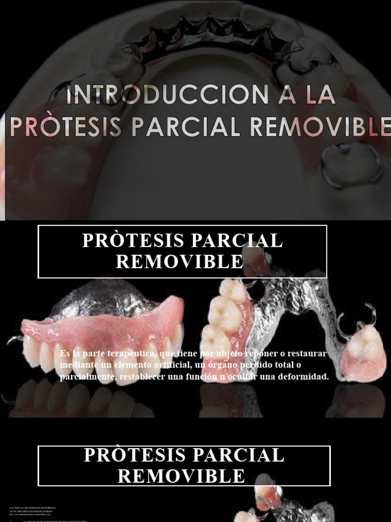 Tipos de ppr conceptos basicos | Descargar gratis PDF | Boca | Odontología