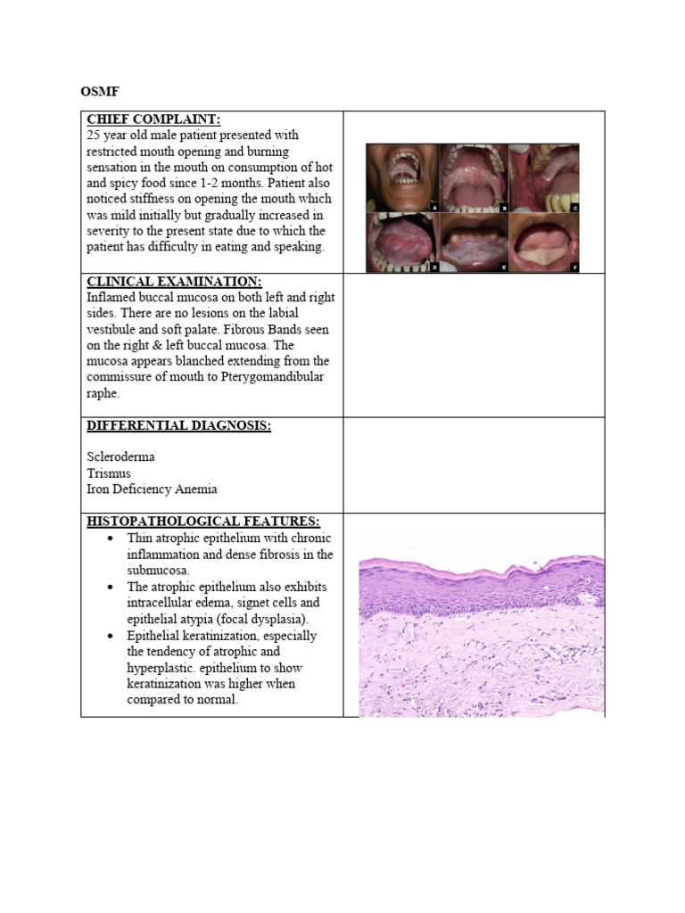 OSMF Case Study: Symptoms & Diagnosis | PDF | Science & Mathematics