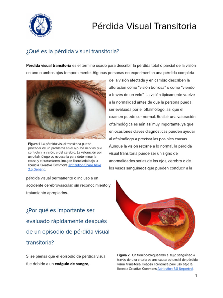 Transient Visual Loss Espanol | PDF | Infarto de miocardio | Carrera