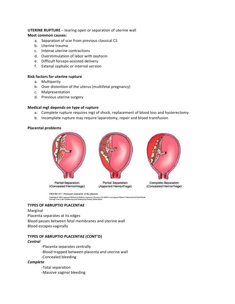 Uterine Rupture | PDF