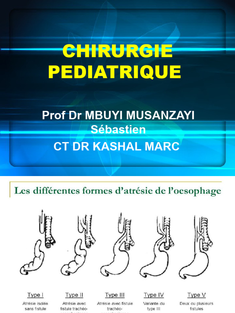 Cours de Chirurgie Pédiatrique Prof Seba (Enregistrement Automatique ...