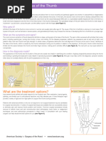 Scaphoid-Trapezium Joint Arthritis Management | PDF | Limbs (Anatomy ...