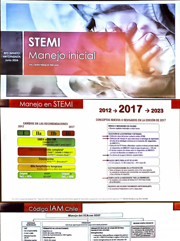 Guía 2024 para Manejo Inicial de STEMI | PDF | Infarto de miocardio ...
