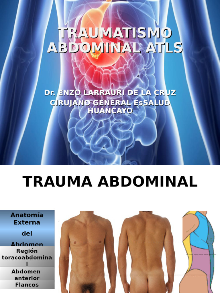 Trauma Abdominal | PDF