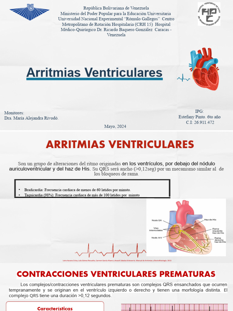 Arritmias Ventriculares: Tipos y Características | PDF ...