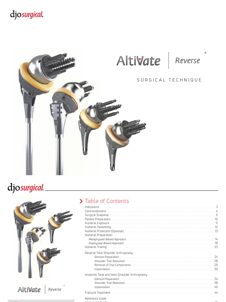 AltiVate Reverse Shoulder Surgery Guide | PDF | Shoulder | Arm