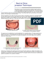 Neutral Zone Impression Technique