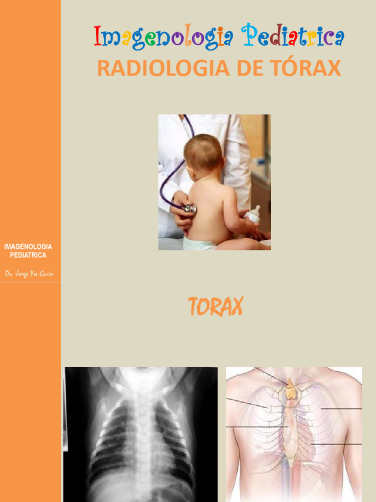 Radiografía de Tórax en Pediatría | PDF | Pulmón | Tórax