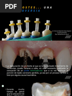Funciones y Ventajas del Endoposte Dental | PDF | Diente | Odontología