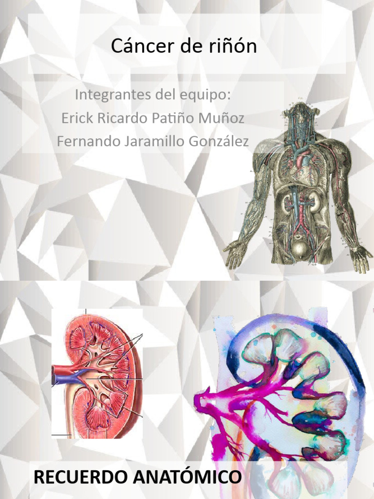 Cáncer de Riñón | PDF | Enfermedades y trastornos | Neoplasias