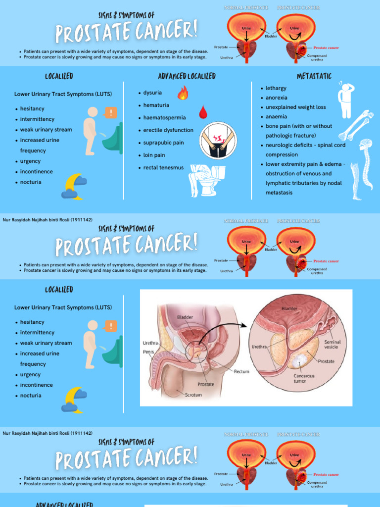 Signs Symptoms of Prostate Cancer PDF | PDF | Prostate Cancer | Prostate