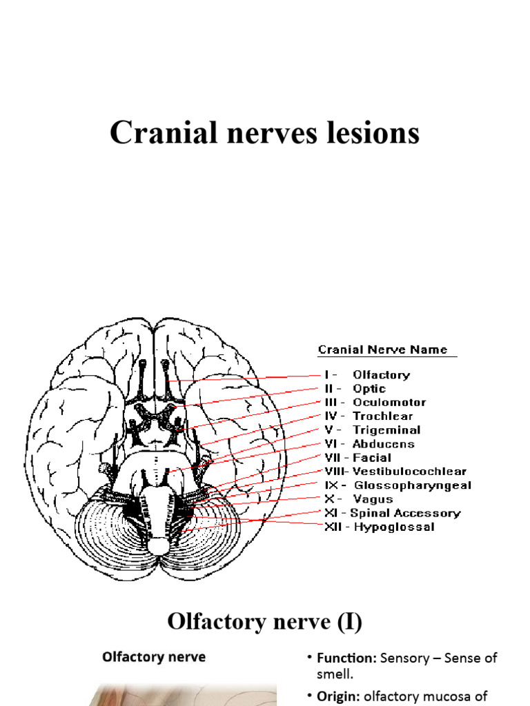 Cranial Nerves Lesions | PDF | Anatomy | Human Head And Neck