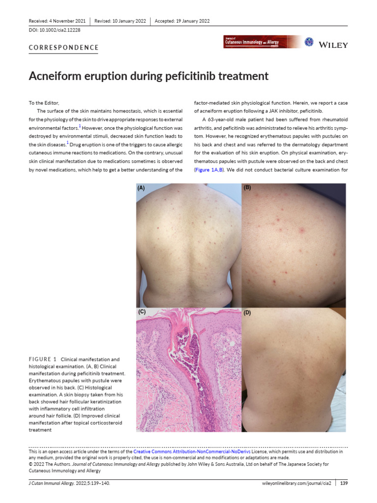 Acneiform Eruption During Peficitinib Treatment | PDF | Medical ...