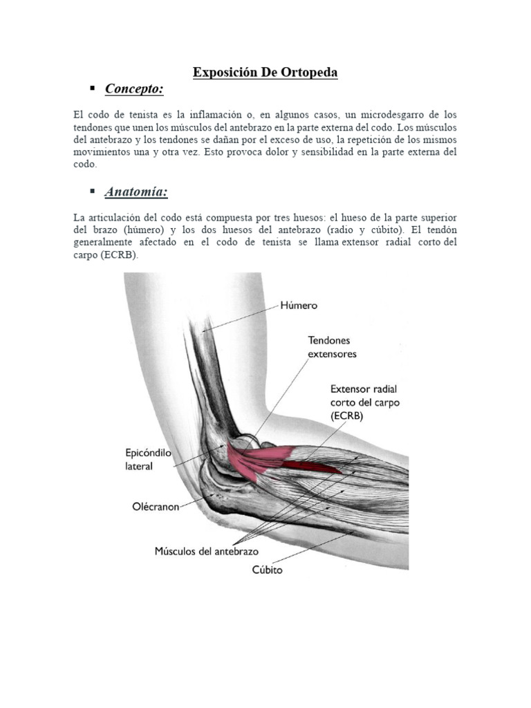 Orto Expo | PDF | Codo | Medicina