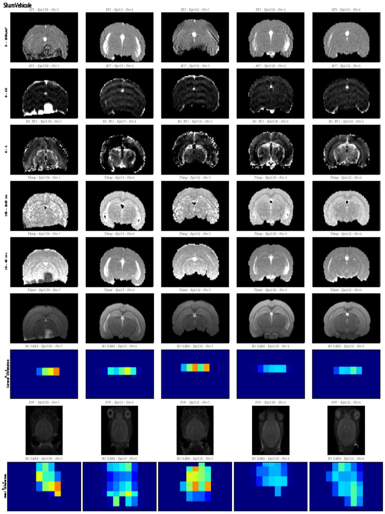 Figure 5 | PDF