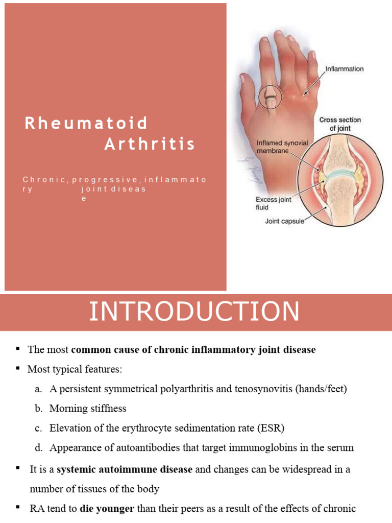 Rheumatoid Arthritis | PDF | Rheumatoid Arthritis | Inflammation