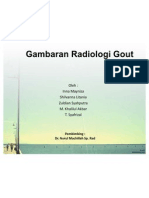 Gambaran Radiologi Gout Artritis