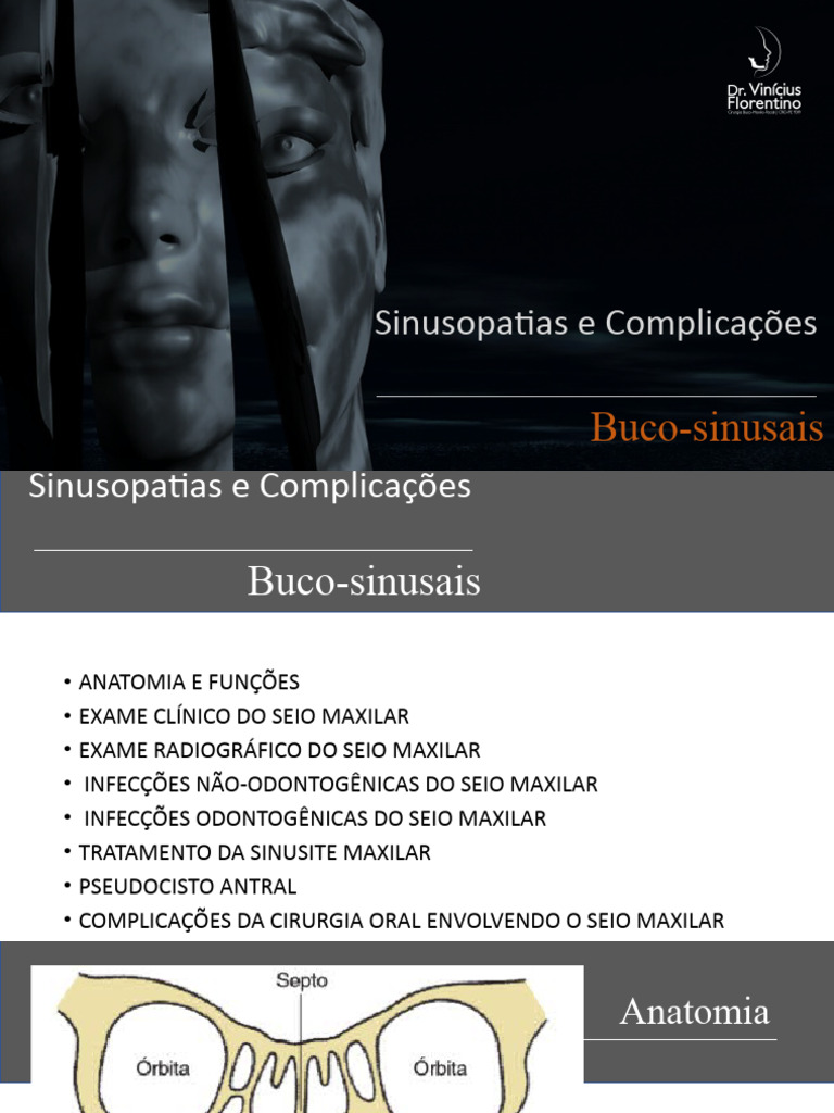 Sinusopatias e Complicações Maxilares | PDF | Doenças e distúrbios ...