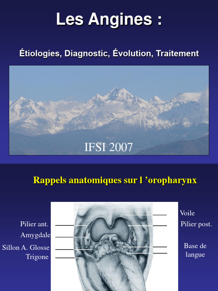 Angines : Étiologies et Traitements | PDF | Épidémiologie | Causes de décès