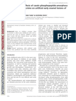 CPP-ACP creme remineralizes early enamel lesions