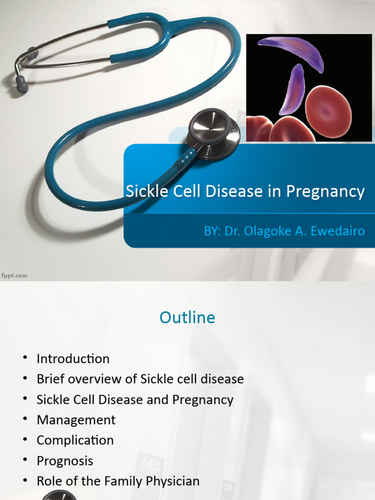 Sickle Cell Disease in Pregnancy 2 | PDF | Pregnancy | Childbirth