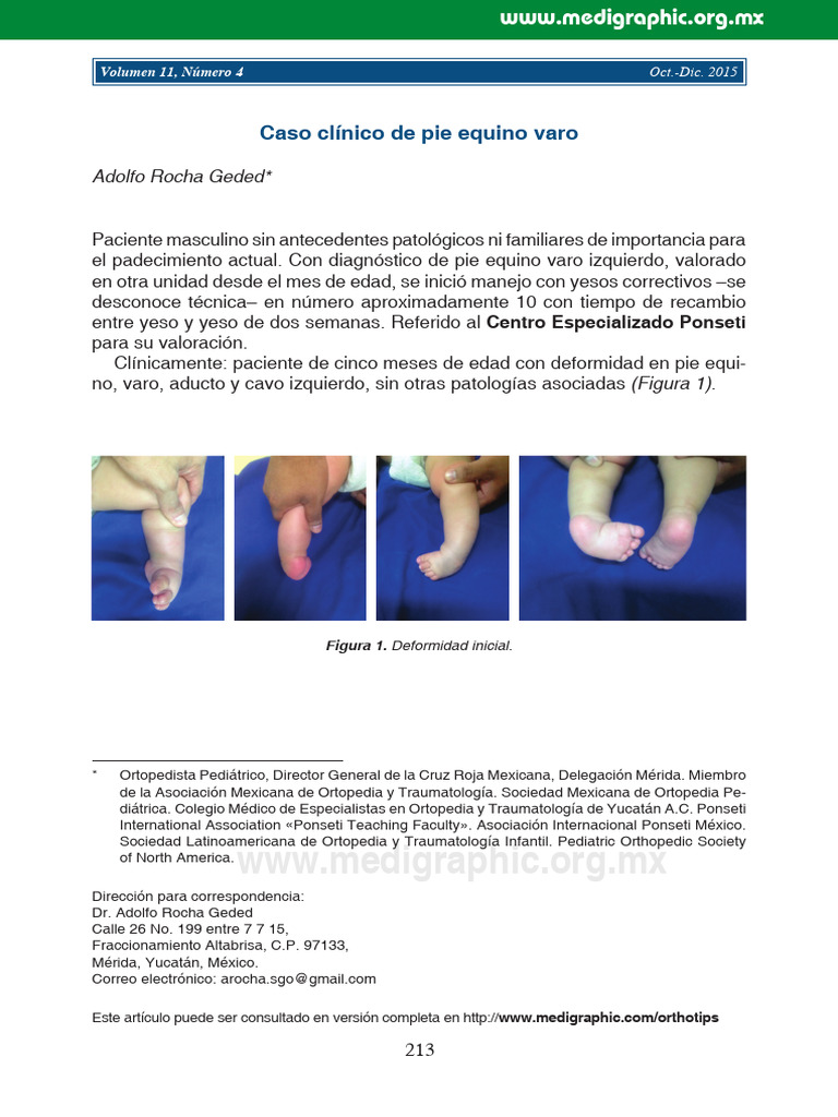 Caso clínico: tratamiento pie equino varo | PDF | Pie | Enfermedades y ...