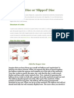 Herniated Disc or